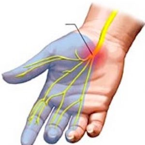 Paume de la main : anatomie, pathologies, traitements
